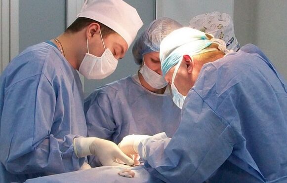 kirurško liječenje proširenih vena